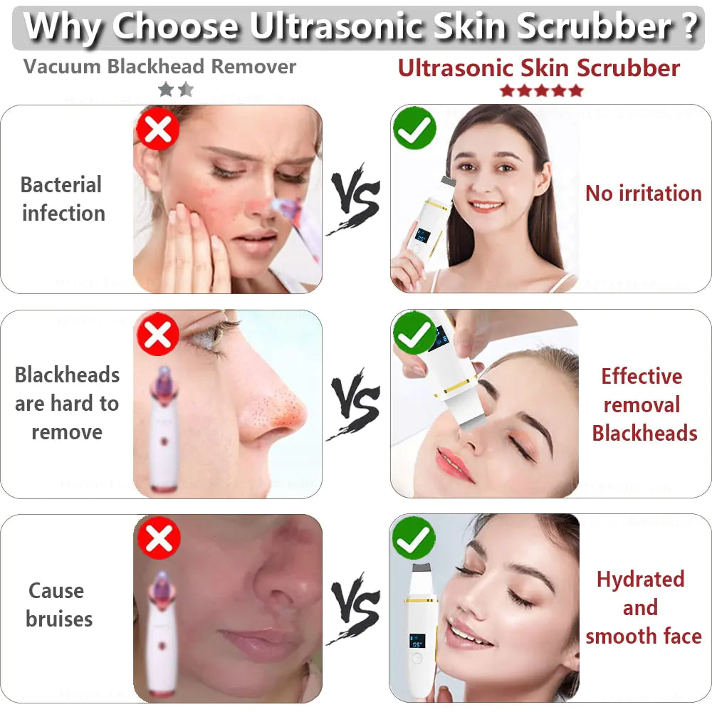 Ultrasonic Skin Scrubber: Facial Cleansing